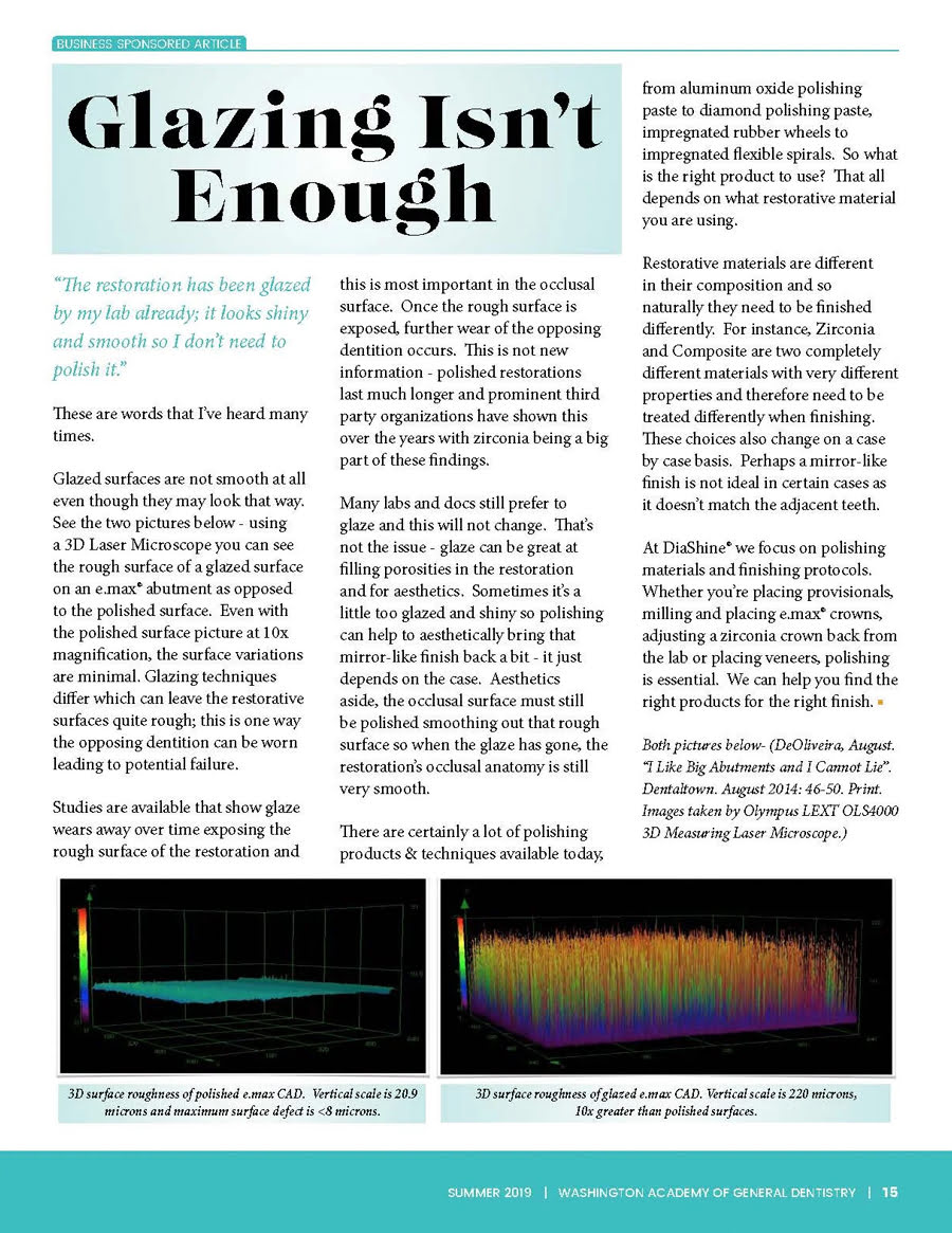 Glazing Isn’t Enough article featured by DiaShine about dental polishing beyond glazing techniques
