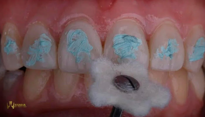 Close-up of Lucida polishing paste texture and felt star