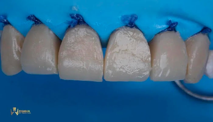 Applying final Lucida paste for high-luster finish