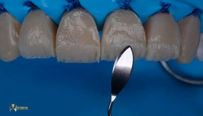 Close-up of polished composite surface reflecting light