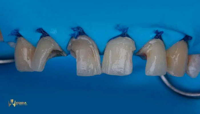 Applying Lucida medium polishing paste for enhanced gloss