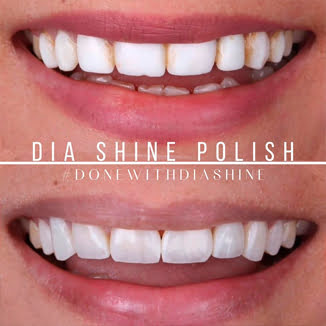 DiaShine Instagram post 10