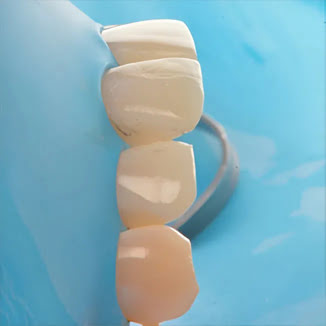 DiaShine Instagram post 3