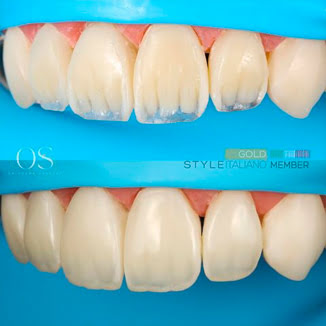 DiaShine Instagram post 8