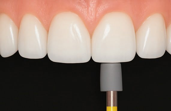 DiaFlex Grey Fine Diamond Rubber Polisher