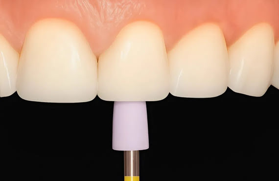 DiaFlex Pink Fine Diamond Silicone Polisher