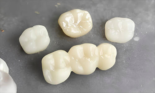 Dental ceramic restorations with enamel-like high-gloss finish