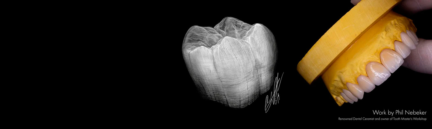 Dental ceramic restoration sketch and finished restorations by Phil Nebeker