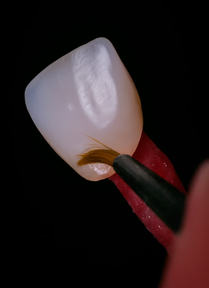 Manual polishing of composite tooth surface