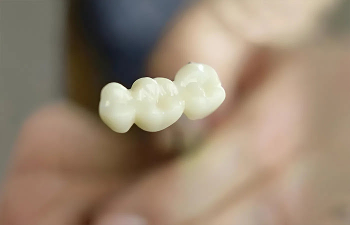 Surface evaluation of polishing techniques for CAD/CAM restorative materials showing DiaShine polished ceramic surface