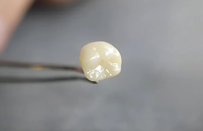Research study showing DiaShine polishing produces smoother dental restoration surfaces compared to glazing