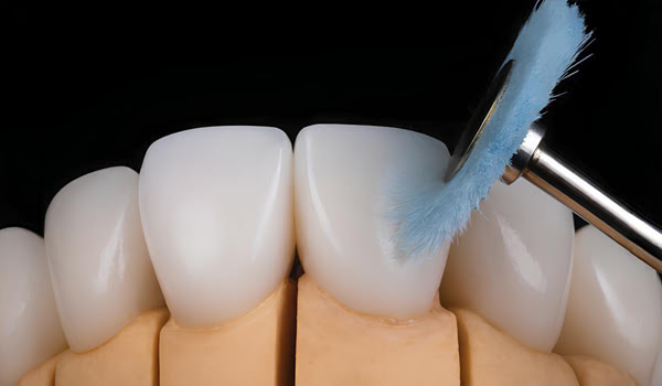 Teeth surface after dental polishing with DiaShine